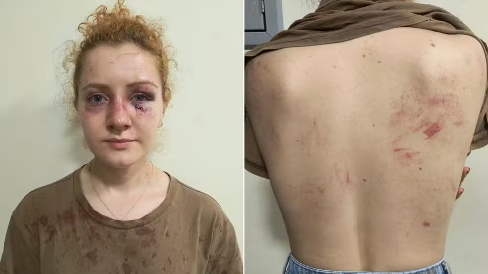 Polícia investiga homem, namorada e sogra por agressão contra jovem na Bahia; vítima era amiga do suspeito